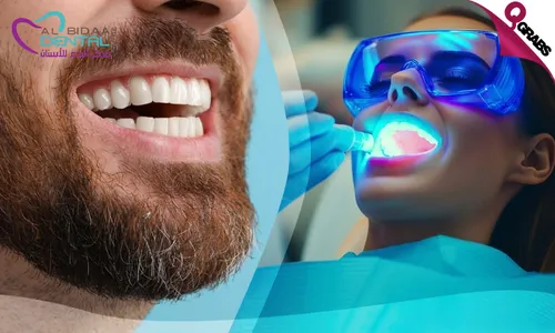 Zoom Teeth Whitening + Consultation!